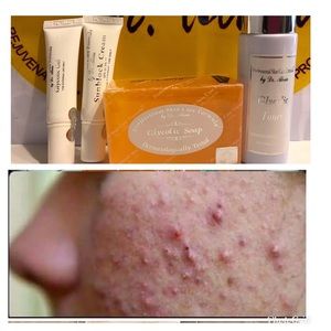 Dr. Alvin PSCF Anti-Acne Pimples Glycolic Set